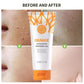 GMEELAN ORANGE EXFOLIATING WHITENING GEL